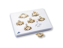 MODEL CERVICAL VERTEBRAE ST/ 7