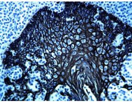 PERMABLACK/HRP CHROMOGEN 30ML