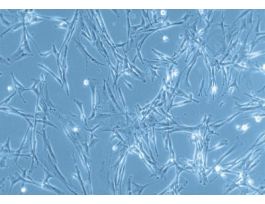 HPF-c: Human Pulmonary Fibroblasts (HPF)