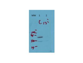 ARFGAP3 ANTIBODY 25UL