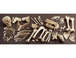 MODEL INTRODISARTICSKELETON