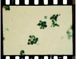 EUDORINA (WM) COLONIES OF 16-64 CELLS;