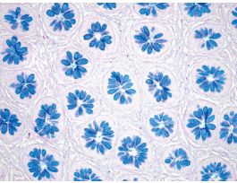 KIT ALCIAN BLUE PAS STAIN 1EA