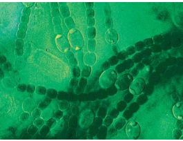 LIVE ANABAENA 120 STUDENTS