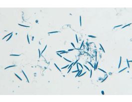 FROG SPERM (SM) IH SLIDE FLAGELLA