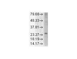 KDEL RECEPTOR ANTIBODY 100UG