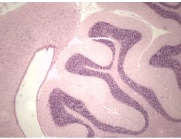 BRAIN-ENTIRE (SECT) H&E M SAGITTAL SECT