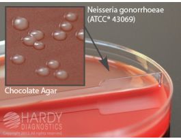 BLOOD AGAR 5%CHOCOLATE BIPLATE