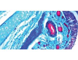 TRICHOME MASSON'S KIT 100RXN