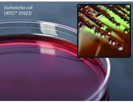 MEDIUM EMB LEVINE AGR 15X100MM PLTD PK10