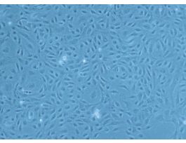 HCMEC-c: Human Cardiac Microvascular Endothelial Cells (HCMEC)
