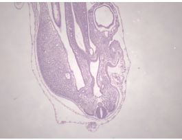 CHICK 72-HOUR TYPICAL SAGITTAL H&E