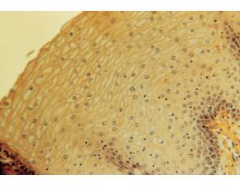 ESOPHAGUS (MAMMALIAN) CS
