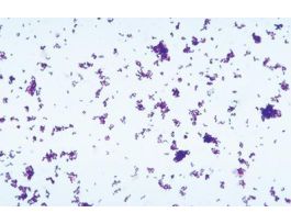 FD CORYNEBACTERIUM XEROSIS W/MEDIA