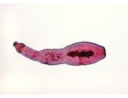 ECHINOCOCCUS GRANULOSUS (WM)