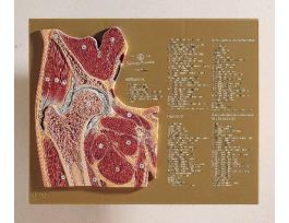 MODEL HIP JOINT XSECTION
