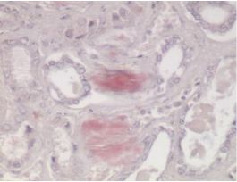 CONGO RED KIT 100RXN