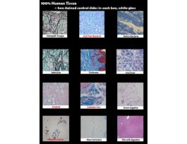 SLIDE HISTOPATH FUNGUS CTRL HUMAN CS22