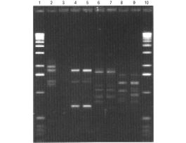 KIT NUCLEON PHYTOPURE 50X1G F/DNA EXTRN