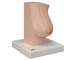 MODEL MODEL OF THE FM BREAST