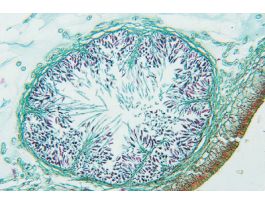 FUCUS-COMBINATION QS MALE & FEMALE