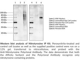 KIT NITROTYROSINE IP PROTEOMIC ANALYSIS