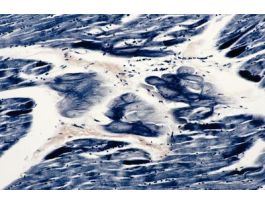 HEART-PURKINJE FIBERS IH MAMALCARDIAC