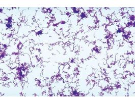 FD STREPTOCOCCUS PYOGENES W/MEDIA