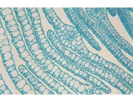 ELODEA-SUBMERGED LEAF (CS)QS SLIDE