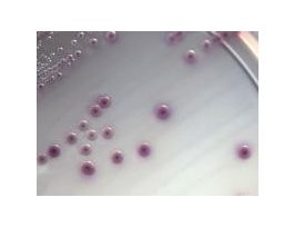 MEDIUM O157 CHRMG PLTD 18ML E.COLI PK10