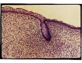 EARLY DENTAL GUM (SECT) MAL(PIG FETUS)