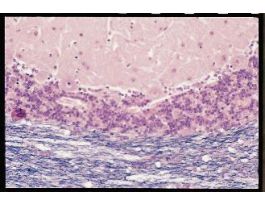 CEREBELLUM (SECT) W&NFR M SPECIAL PREP