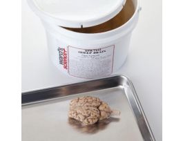 EXTRACTED GEN. DISS. BRAIN PL/10 PM