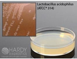 MEDIUM BARNEY MILLER 15X60MM PLATED PK10