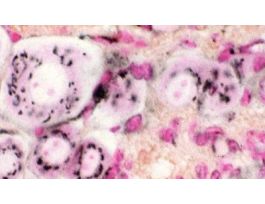 GOLGI APPARATUS (SECT) DAF&NFR GANGLION