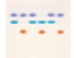 Kt Whose DNA Was Left Behind Edvotek