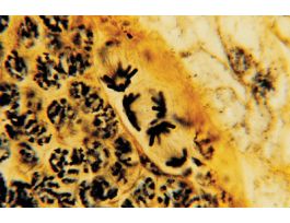 GRASSHOPPER-TESTIS (SECT) IH&OG SLIDE.