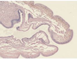 EARTHWORM-ANTERIOR REGION (LS) H&E