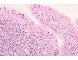 ILEUM-PEYER'S PATCHES (SECT) 1.5UM H&E