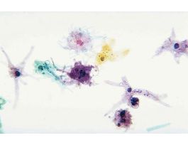 AMOEBA PROTEUS SELECTED (WM)