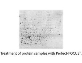 KIT ELP CLEAN UP PERFECT-FOCUS 50PREPS