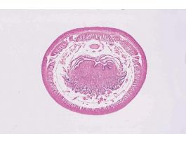 EARTHWORM (LUMBRICUS TERRESTRIS) CS OF