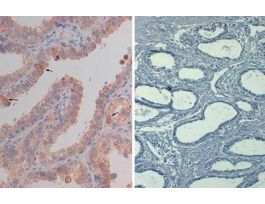 AKT PHOSPHO S473 AB 50UG