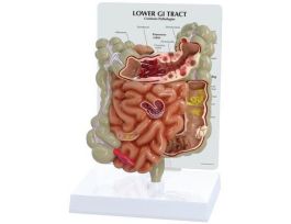MODEL COLON AND GI TRACT