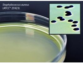MEDIUM BAIRD PARKER AGAR PLTD STAPH PK10