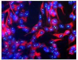 FIBRILLARIN ANTIBODY 100 UL