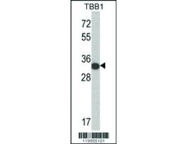 6XHIS TAG ANTIBODY