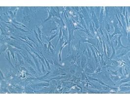 HCF-c: Human Cardiac Fibroblasts (HCF)