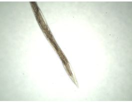 ANCYLOSTOMA DUODENALE-FEMALE (WM) SLIDE