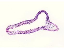 HYDRA ADULT WITHBUD(LS)H&EGASTROVASCULAR